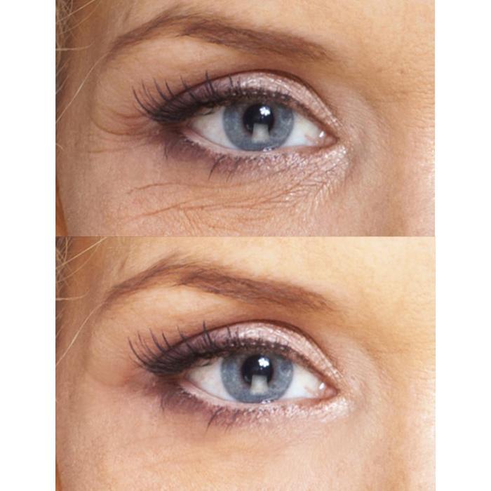 LE'VEA Youth Treatment: Eye Wrinkle Treatment + Night Repair Cream