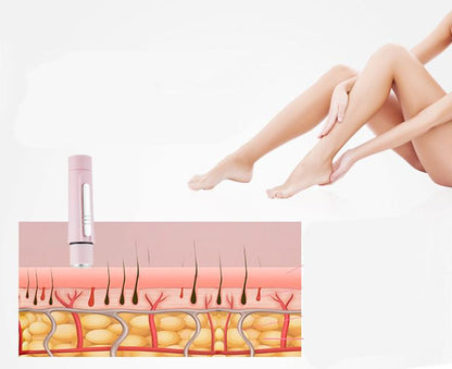 Illustration of a hair removal device with a close-up of skin layers and a person's legs.