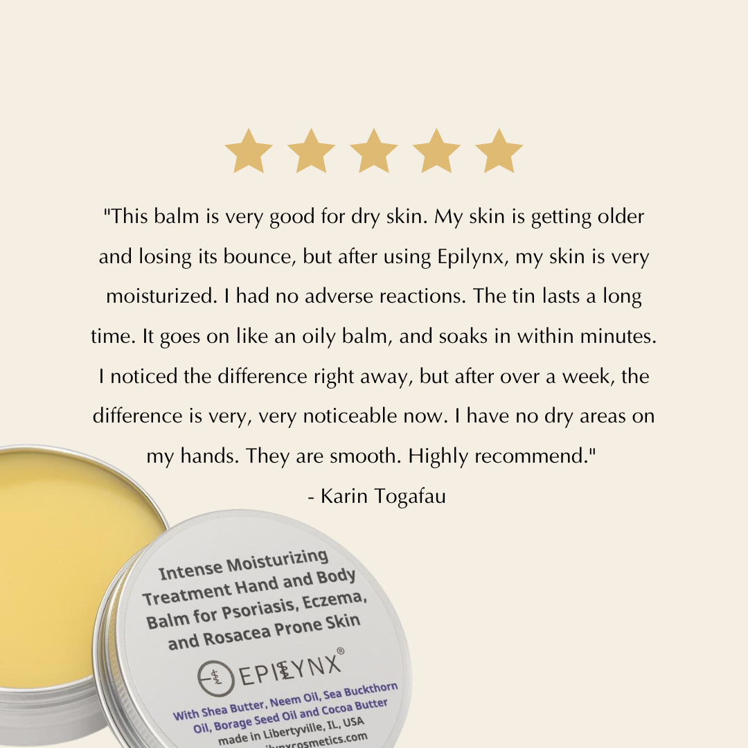 Epilynx balm with a five-star rating and customer review on a beige background