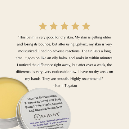 Epilynx balm with a five-star rating and customer review on a beige background