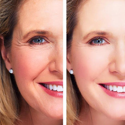 LE'VEA Youth Treatment: Eye Wrinkle Treatment + Night Repair Cream
