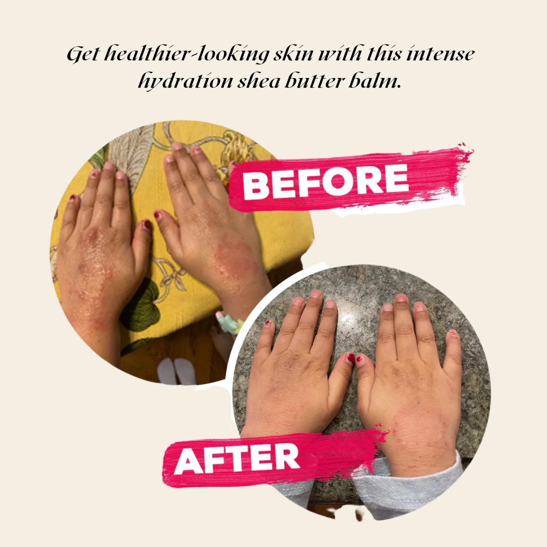 Before and after comparison of hands with a shea butter balm application on a beige background.